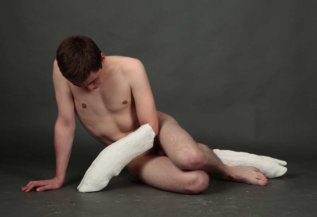 Portrait de l'artiste, nu et posrtant des protèses en formes de pieds blancs de vaches à la place des bras.